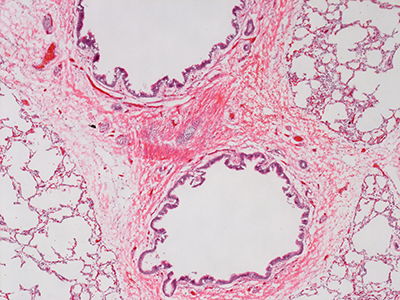 H&E Staining of a 1 Day-Old Human Lung D019-LLL-5B1.24