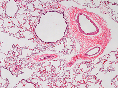 H&E Staining of a 1 Day-Old Human Lung D019-LLL-6A2.18