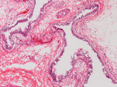 H&E Staining of a 1 Day-Old Human Lung D038-LLL-7A2.17
