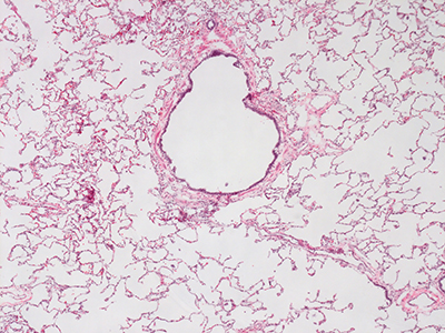 H&E Staining of a 1 Day-Old Human Lung D038-LLL-8A2.41