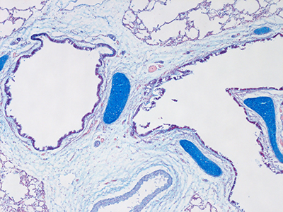 Alcian Blue Staining of a 1 Day-Old Human Lung D019-LLL-5B1.15