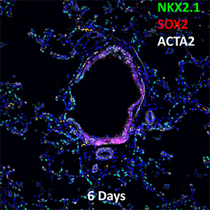 6 Day-Old Human Lung NKX2.1, SOX2, and ACTA2 Confocal Imaging