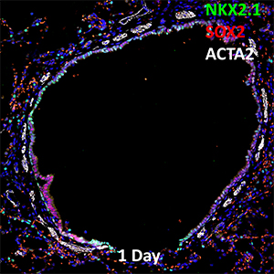 1 Day-Old Human Lung NKX2.1, SOX2, and ACTA2 Confocal Imaging