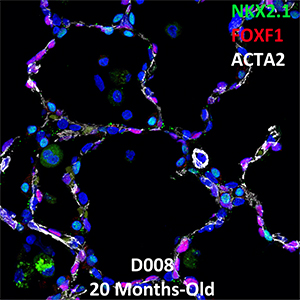 20 Month Old Human Lung LMH-16-D008 NKX2.1, FOXF1, and ACTA2