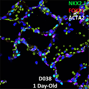 1 Day-Old Human Lung LMH-16-D038 NKX2.1, FOXF1, and ACTA2