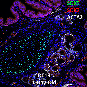 1-Day-Old Human Lung LMH-D019 SOX9, SOX2, and ACTA2 Confocal Imaging