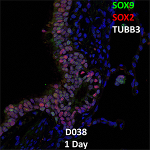 1-Day-Old Human Lung SOX9, SOX2, and TUBB3 Confocal Imaging