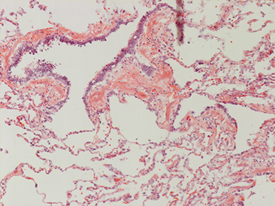 H&E Staining 31 Year Old Human Lung DD034L-MC15-03H_3_21