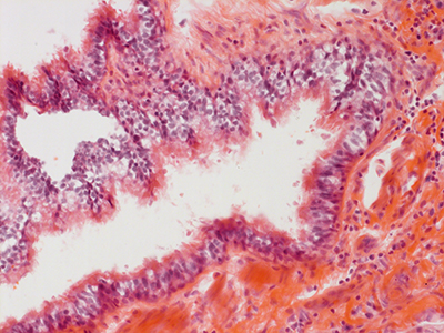 H&E Staining 31 Year Old Human Lung DD034L-MC15-03H_3_11