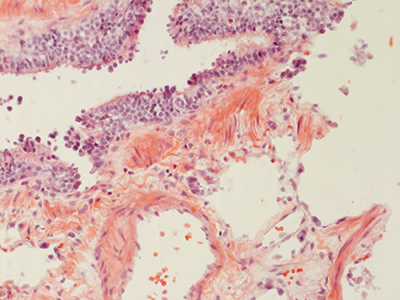 H&E Staining 31 Year Old Human Lung DD034L-MC15-03H_3_20