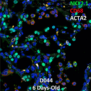 6 Day-Old Human Lung Confocal Imaging NKX2.1, CD68, and ACTA2