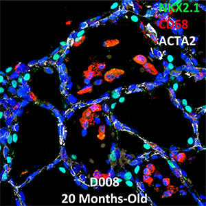 20 Month-Old Human Lung Confocal Imaging NKX2.1, CD68, and ACTA2