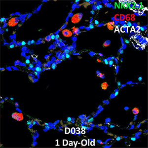 1 Day-Old Human Lung Confocal Imaging NKX2.1, CD68, and ACTA2