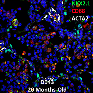 20 Month-Old Human Lung Confocal Imaging NKX2.1, CD68, and ACTA2