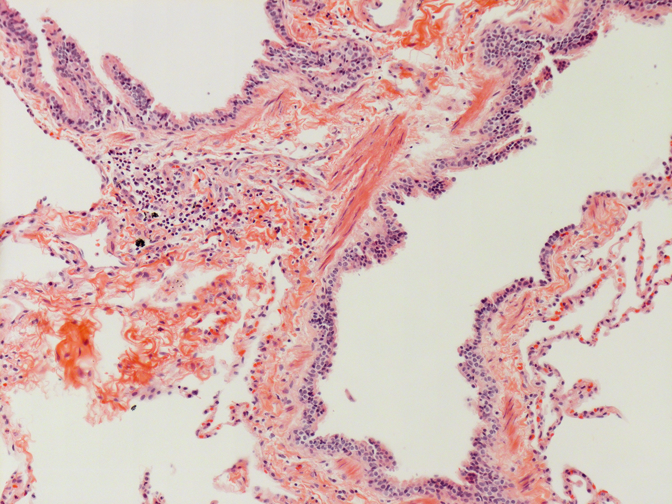 H&E Staining of Adult Human Lung D0037L.05HP_3_48
