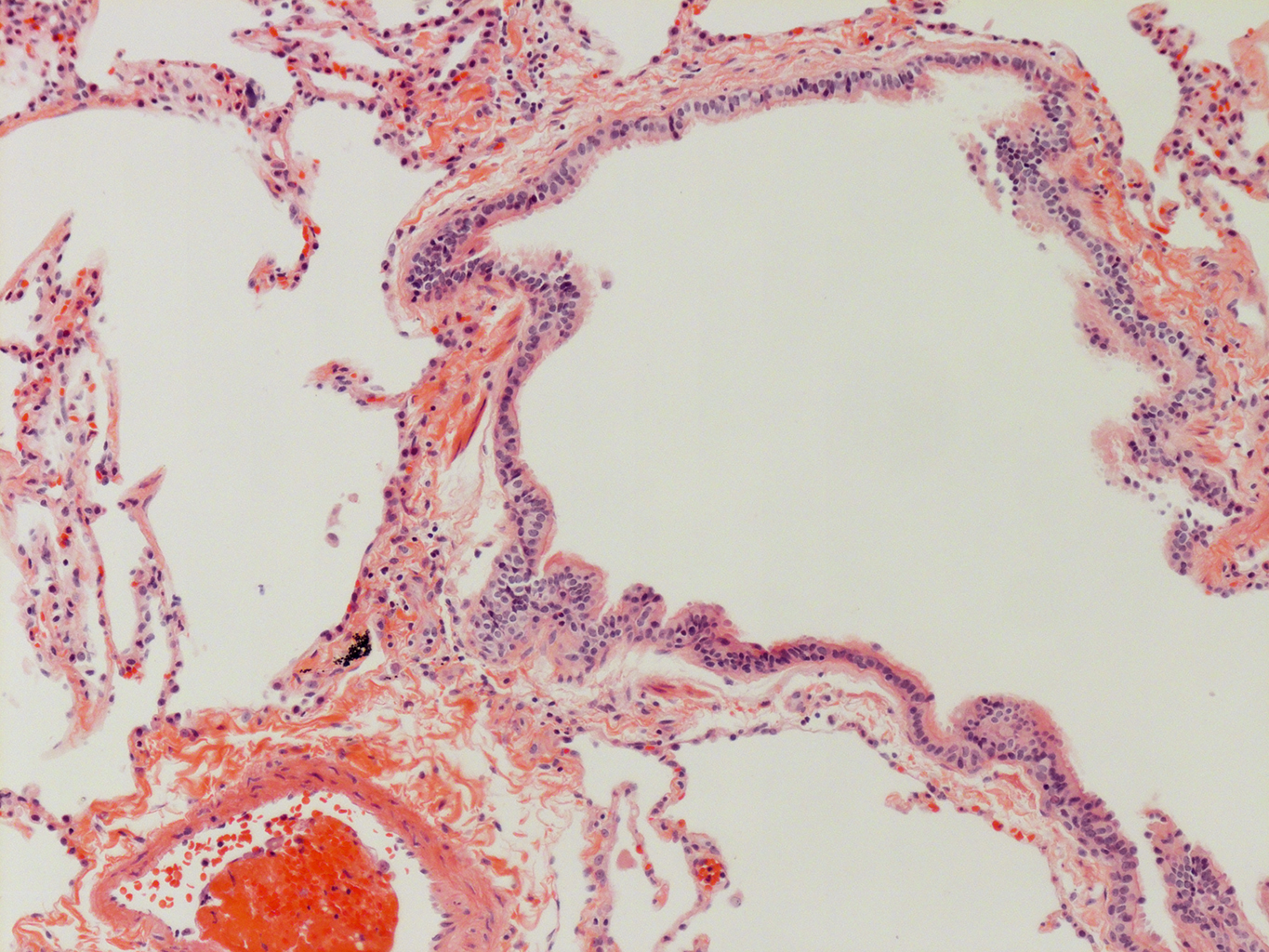 H&E Staining of Adult Human Lung D0037L.05HP_3_48