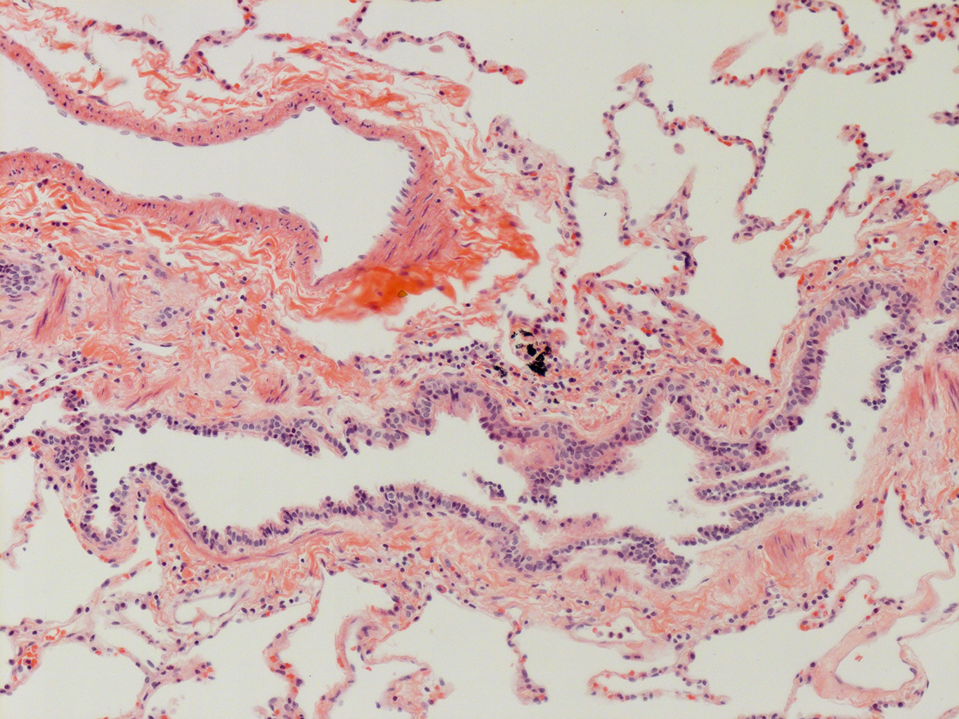 H&E Staining of Adult Human Lung D0037L.05HP_3_48