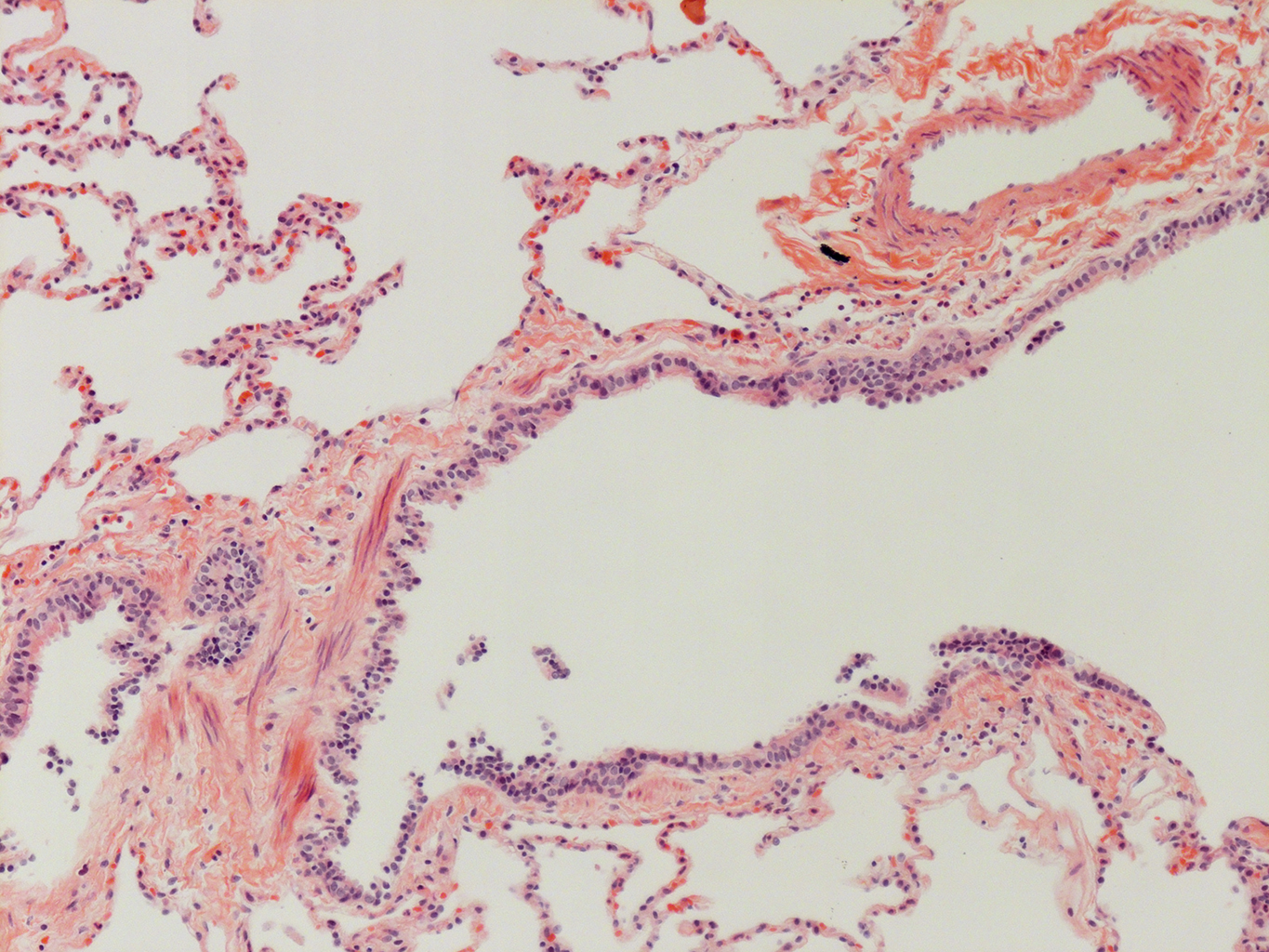 H&E Staining of Adult Human Lung D0037L.05HP_3_48