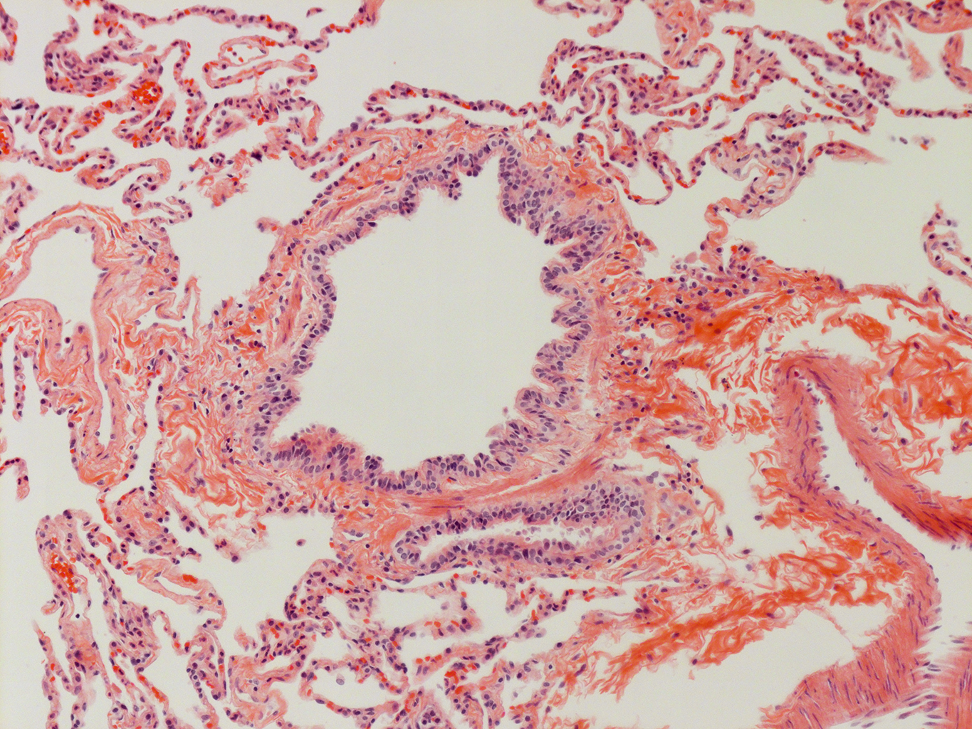 H&E Staining of Adult Human Lung D0037L.05HP_3_48