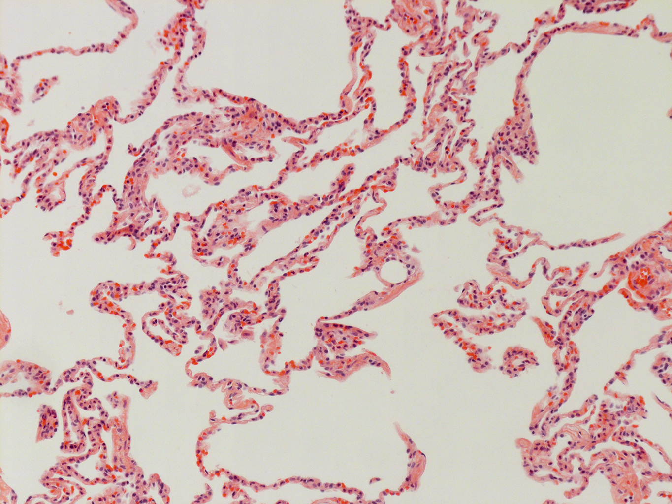 H&E Staining of Adult Human Lung D0037L.05HP_3_48