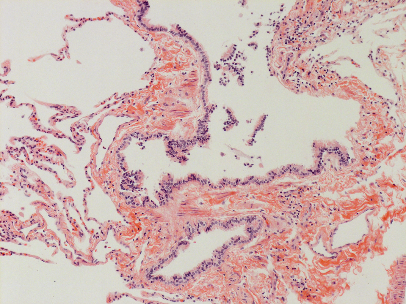 H&E Staining of Adult Human Lung D0037L.05HP_3_48