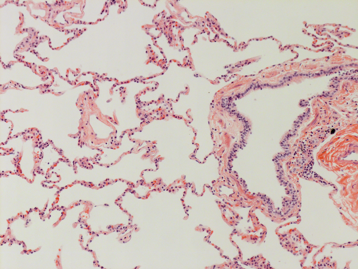 H&E Staining of Adult Human Lung D0037L.05HP_3_48
