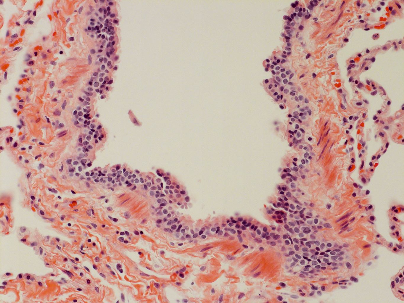 H&E Staining of Adult Human Lung D0037L.05HP_3_48