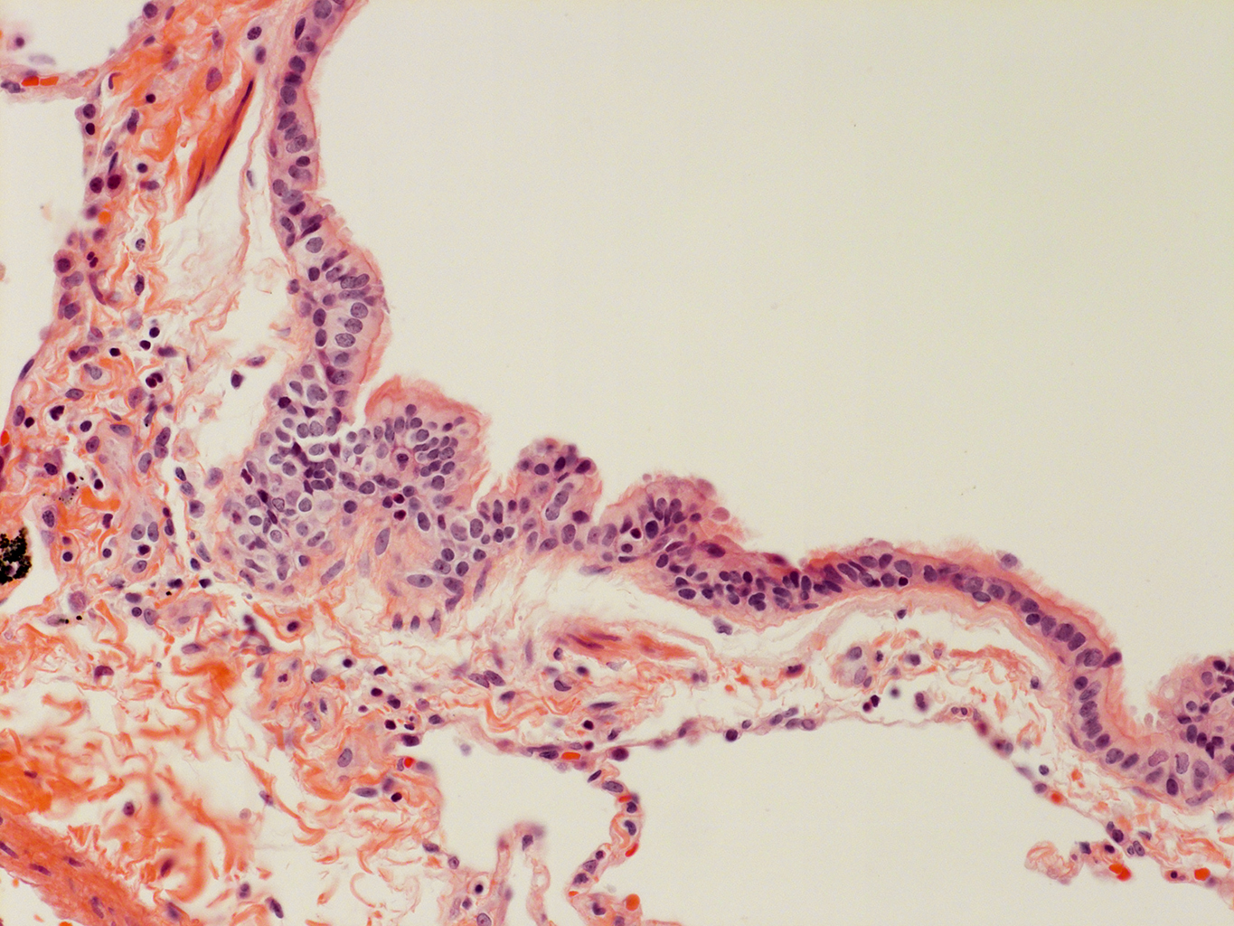H&E Staining of Adult Human Lung D0037L.05HP_3_48