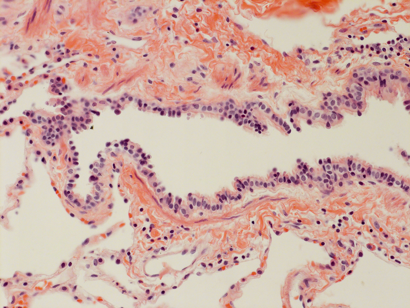H&E Staining of Adult Human Lung D0037L.05HP_3_48