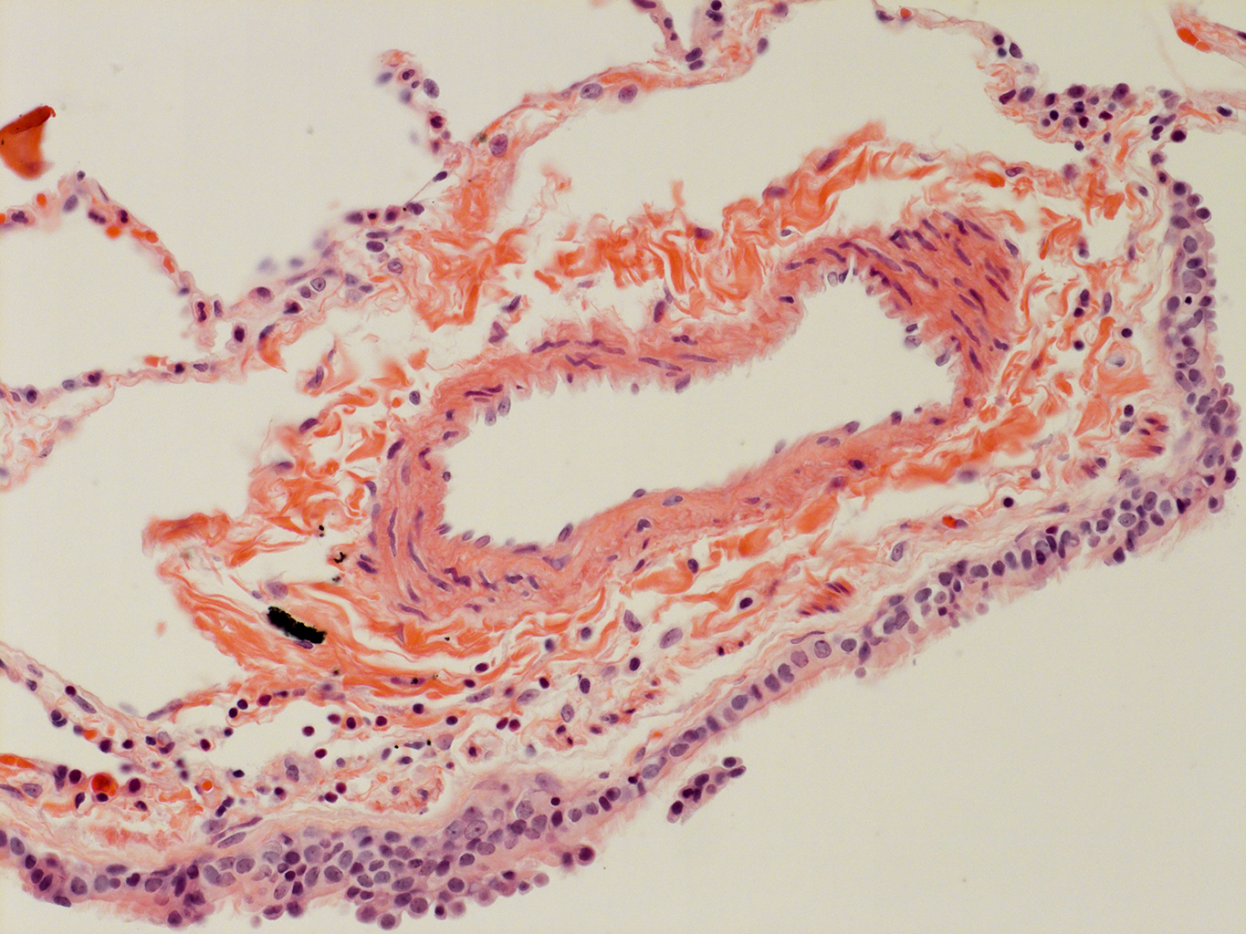 H&E Staining of Adult Human Lung D0037L.05HP_3_48