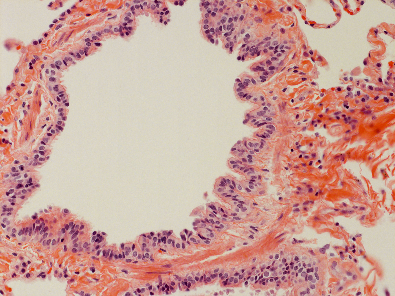 H&E Staining of Adult Human Lung D0037L.05HP_3_48