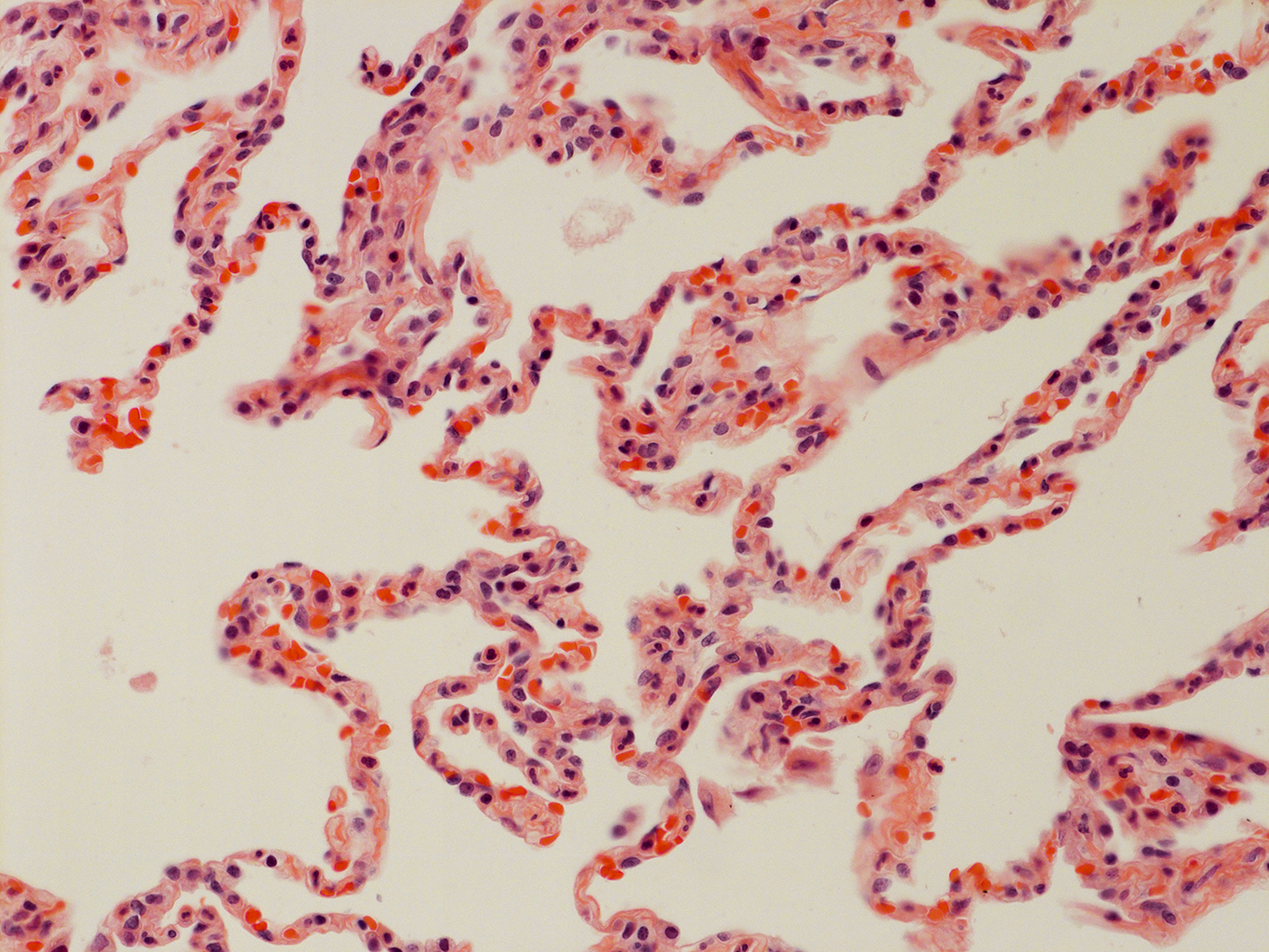 H&E Staining of Adult Human Lung D0037L.05HP_3_48