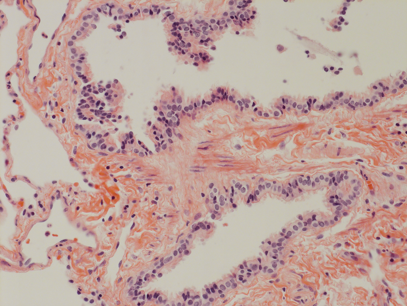 H&E Staining of Adult Human Lung D0037L.05HP_3_48