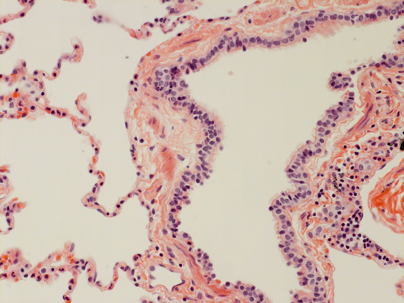 H&E Staining of Adult Human Lung D0037L.05HP_3_48
