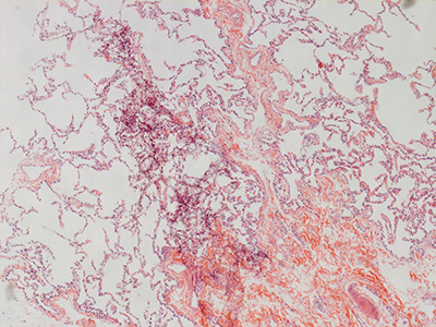 H&E Staining of 47 Year Old Human Lung D0037.05HP-#2-01