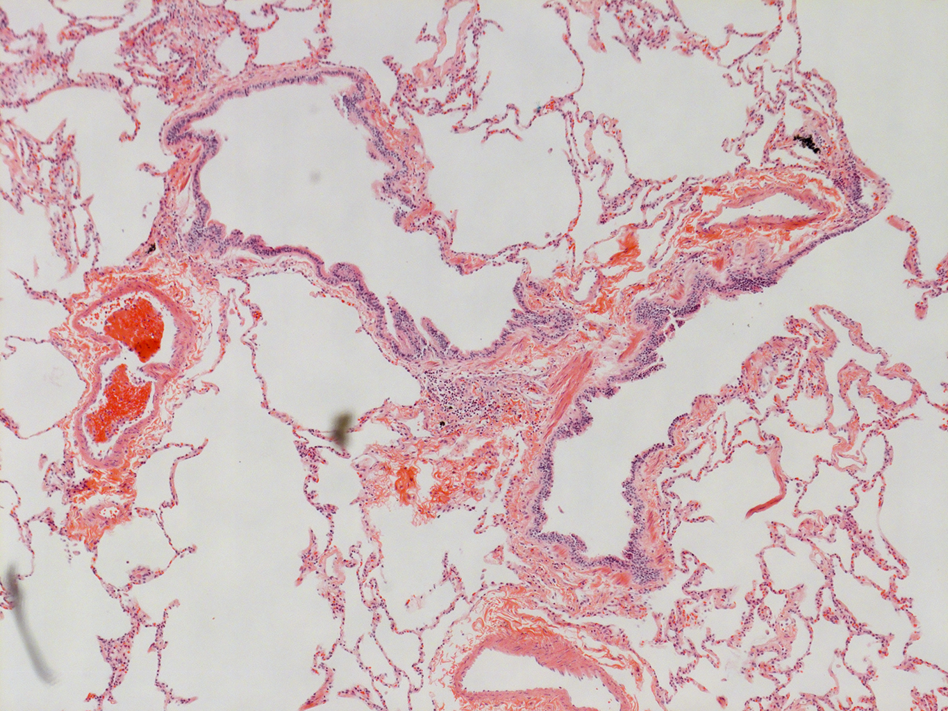H&E Staining of Adult Human Lung D0037L.05HP_3_48