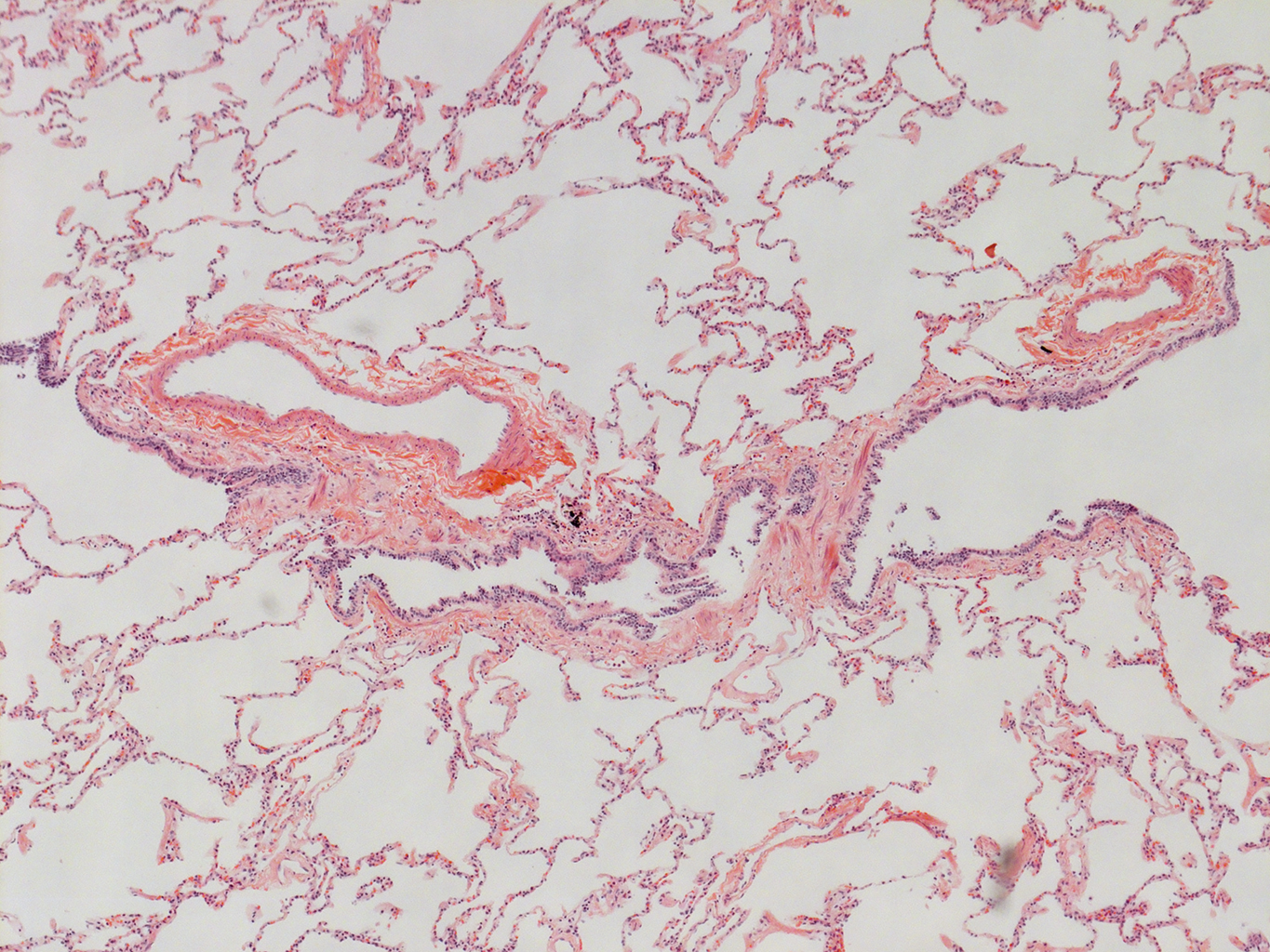 H&E Staining of Adult Human Lung D0037L.05HP_3_48