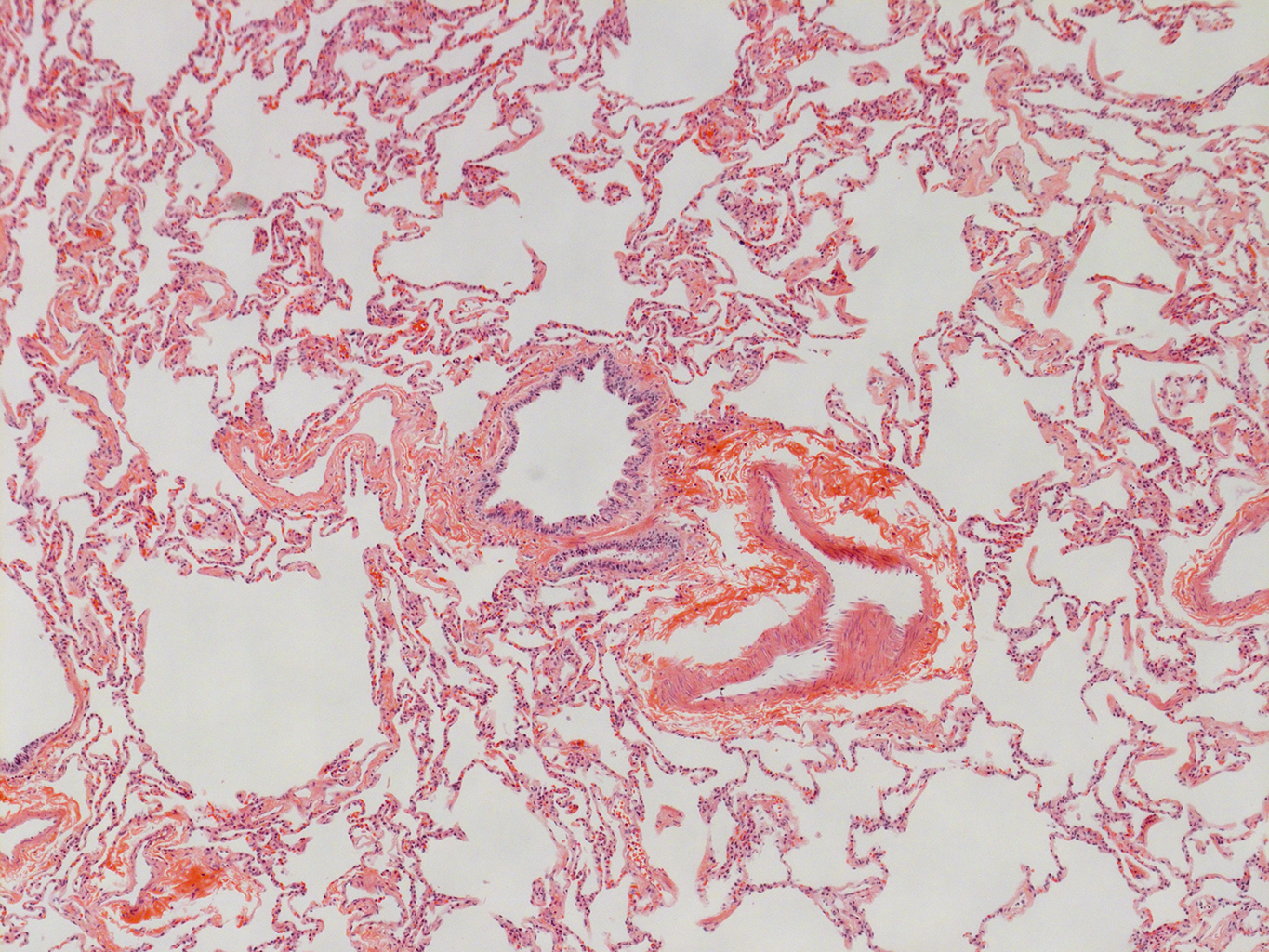 H&E Staining of Adult Human Lung D0037L.05HP_3_48
