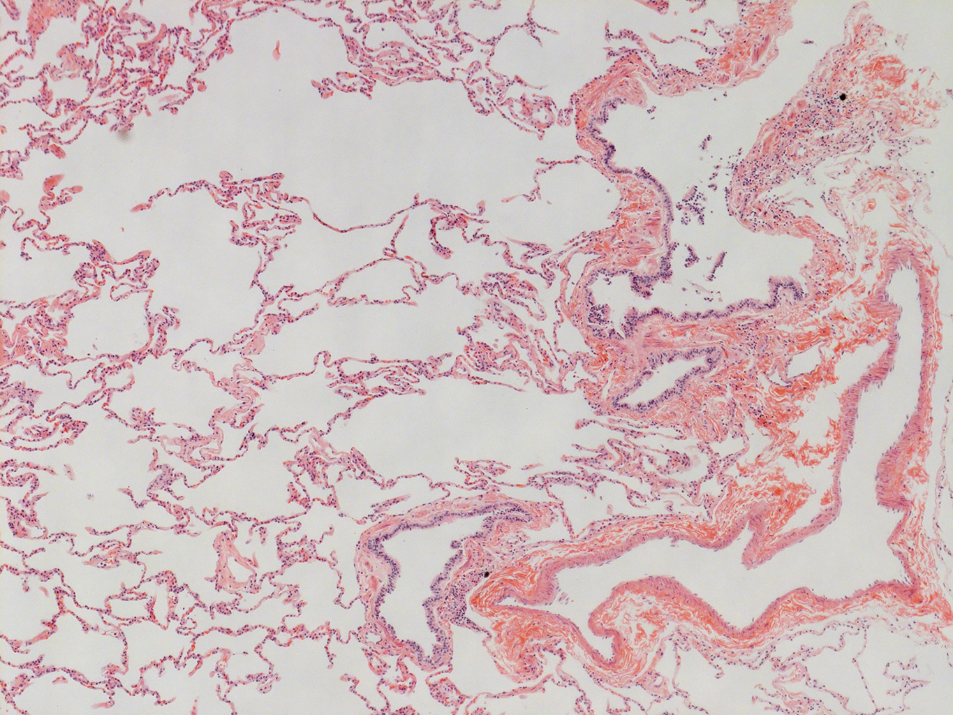 H&E Staining of Adult Human Lung D0037L.05HP_3_48