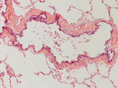 H&E Staining 31 Year Old Human Lung DD034L_MC15-05H_3_20