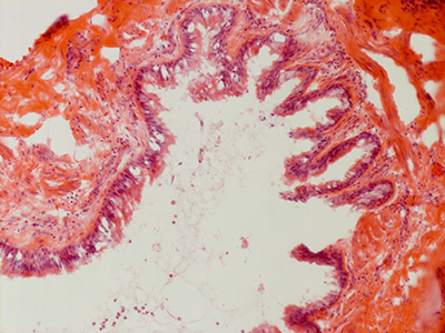 H&E Staining 31 Year Old Human Lung DD034L_MC15-05H_3_21