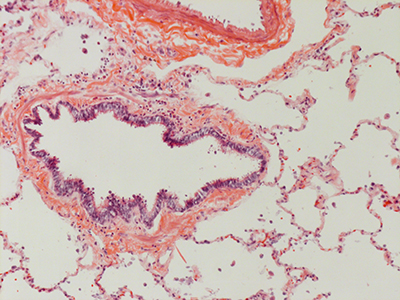 H&E Staining 31 Year Old Human Lung DD034L-MC15-03H_3_10