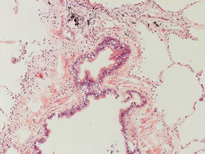 H&E Staining 31 Year Old Human Lung DD034L-MC15-04H_4_11