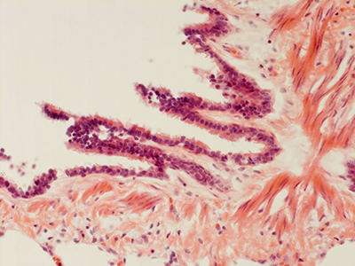 H&E Staining 31 Year Old Human Lung DD034L-MC15-04H_4_10