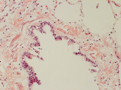 H&E Staining 31 Year Old Human Lung DD034L-MC15-04H_4_20
