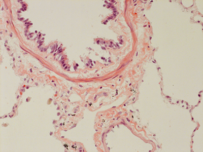 H&E Staining 31 Year Old Human Lung DD034L_MC15-04H_4_21