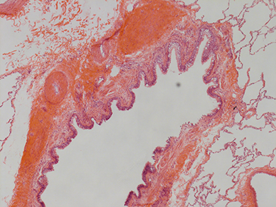 H&E Staining 31 Year Old Human Lung DD034L_MC15-05H_3_10