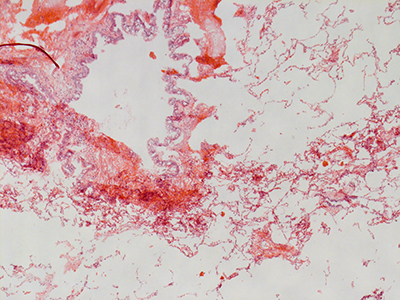 H&E Staining 31 Year Old Human Lung DD034L_MC15-05H_3_11