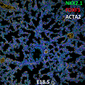 E18.5 C57BL6 NKX2.1, FOXF1, and ACTA2 Confocal Imaging