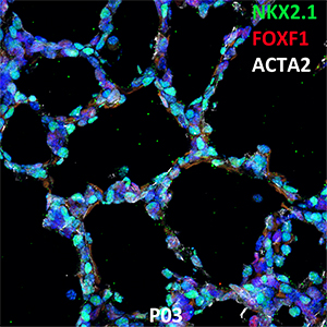 Postnatal Day 03 C57BL6 NKX2.1, FOXF1, and ACTA2 Confocal Imaging